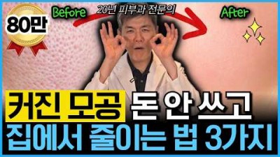 모공 줄이는 홈케어 방법, 얼굴 피부에 않좋은 행동 습관 및 관리 방법, 넓어진 모공 줄이는 홈케어 방법 정보