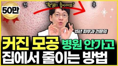 모공에 안좋은 습관, 모공 관리 홈케어 방법, 모공이 커지는 원인 및 관리 방법