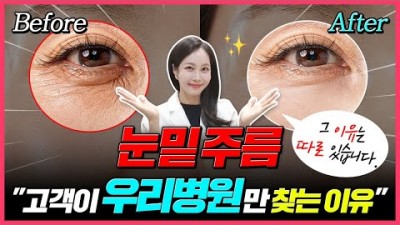 눈 주변 주름 관리 방법, 눈밑 주름 원인 및 관리 방법, 눈가 잔주름 관리 및 치료 시술 방법 정보